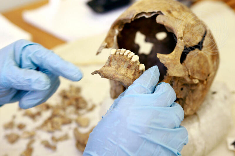 UNMIT Foresic Anthropologist Examines Human Skull