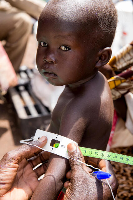 UNICEF, WFP Launch Joint Nutrition Response Plan for South Sudan